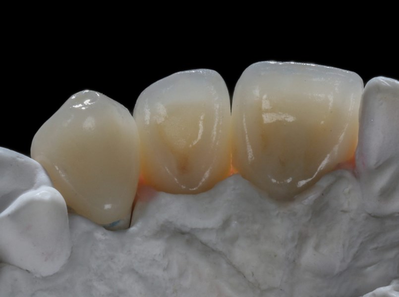 capsula dentale