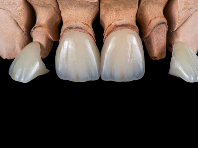 capsula dente