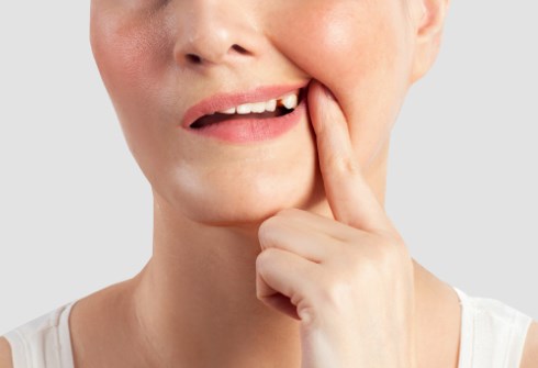 dente rotto