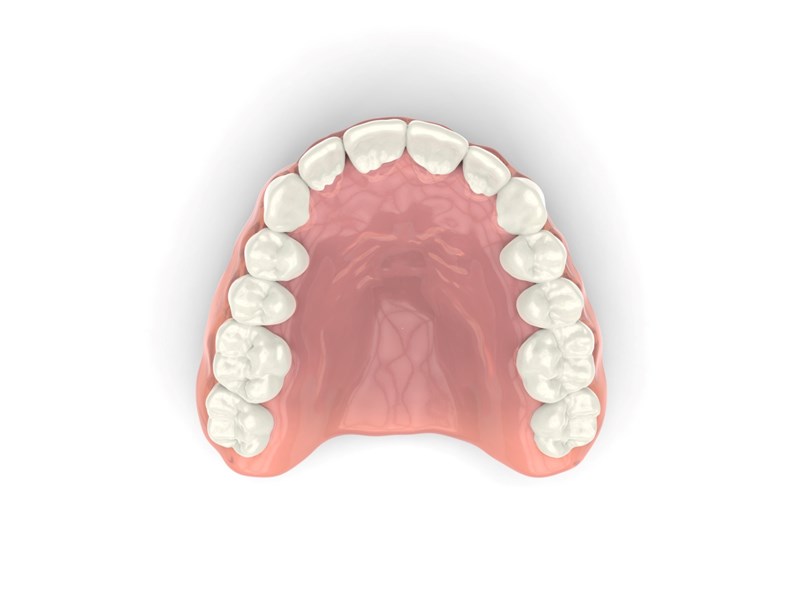 dentiera mobile
