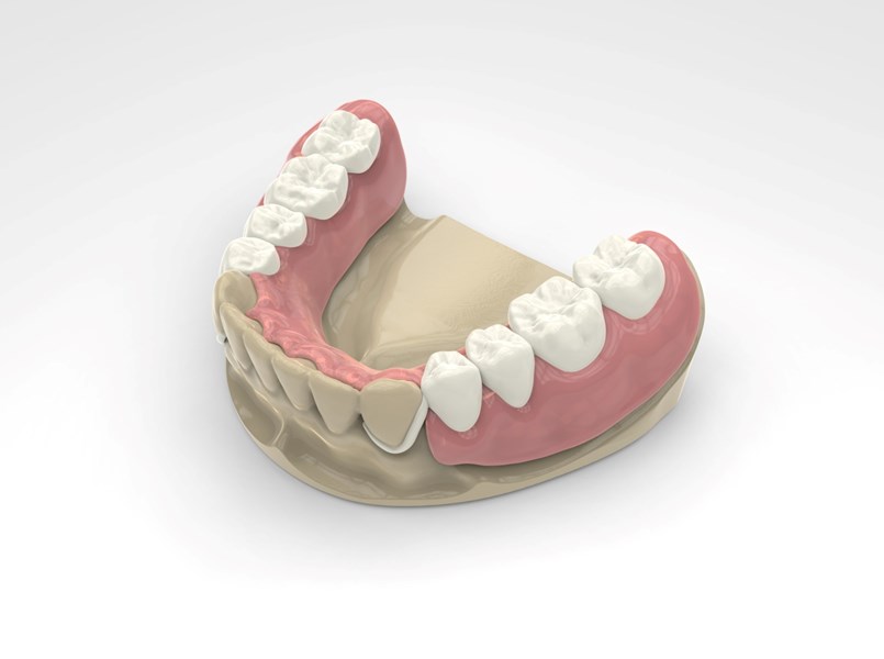 dentiera