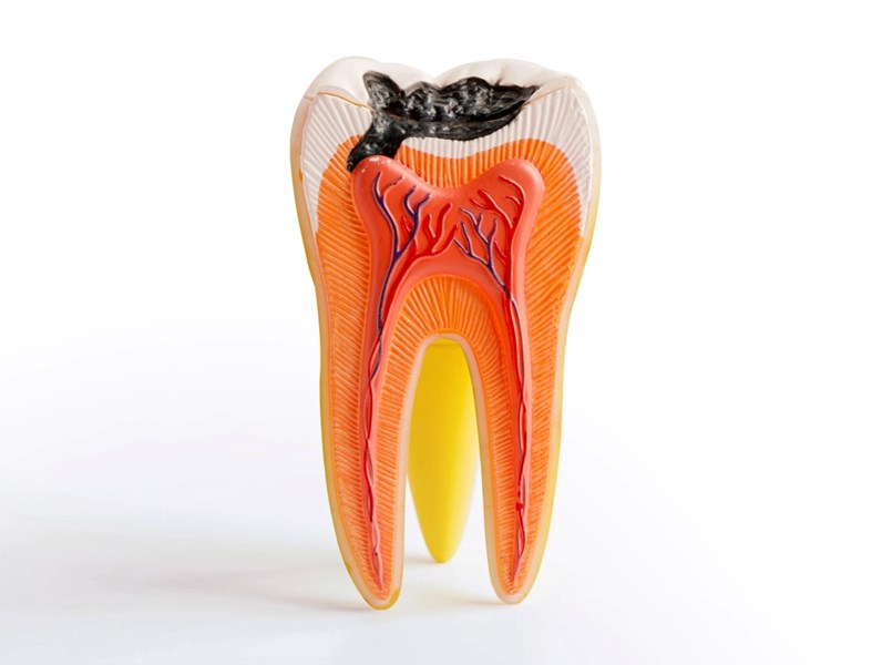 malattie dei denti