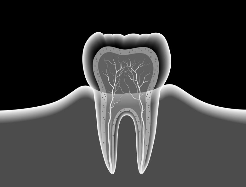 radiografia dentale