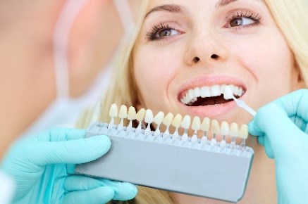 sbiancamento denti costo