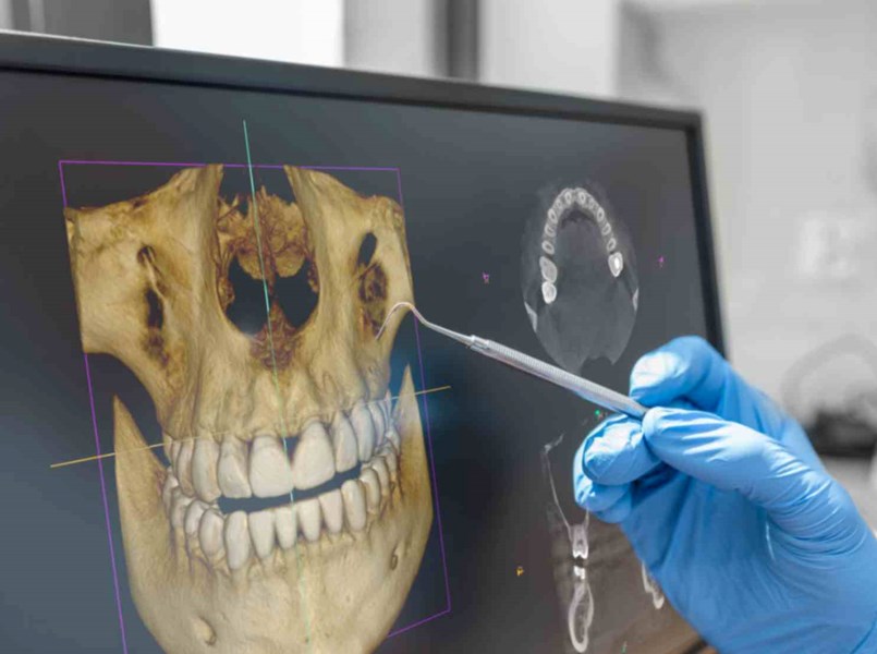tac dentale 3d costo