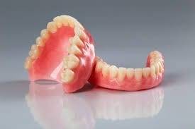 tipi di protesi dentale