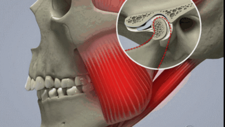 Disturbi dell’articolazione mandibolare