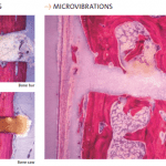 Microvibrazioni